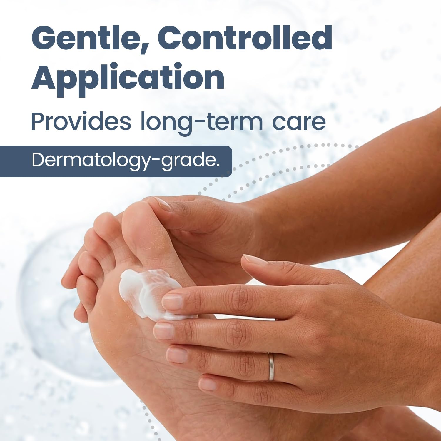 HONGOCURA - Antifungal Cream for Athlete’s Foot | 20 gm | 1-Pack
