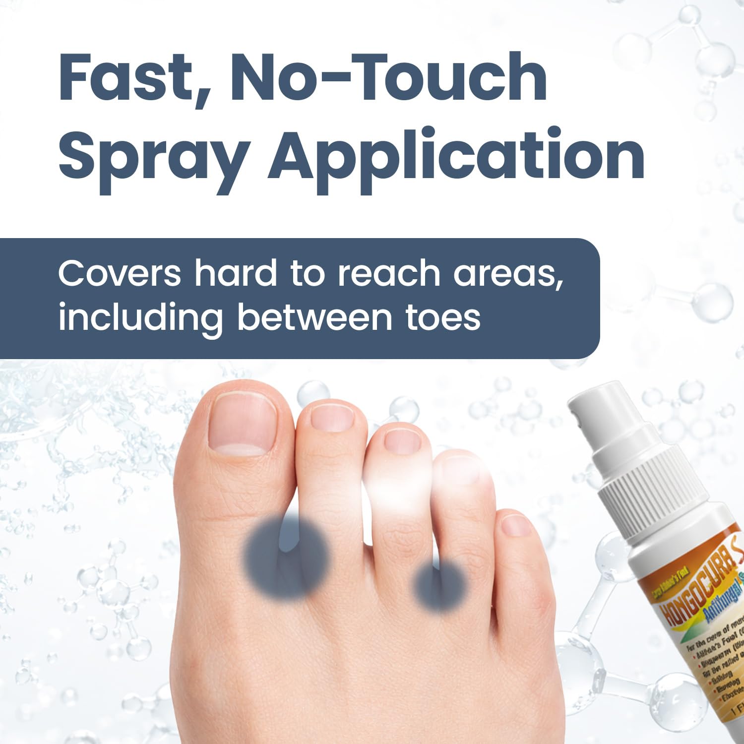 HONGOCURA - Athletes Foot Spray | 1 Fl Oz | 1-Pack