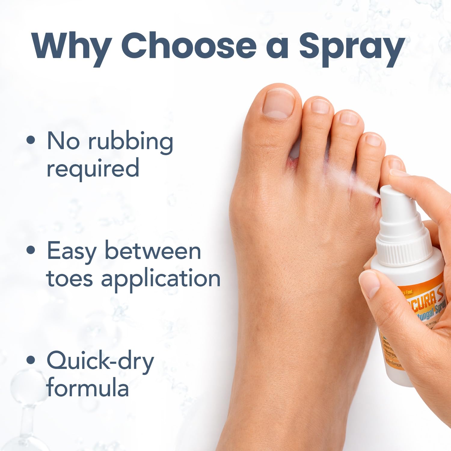 HONGOCURA - Athletes Foot Spray | 1 Fl Oz | 1-Pack