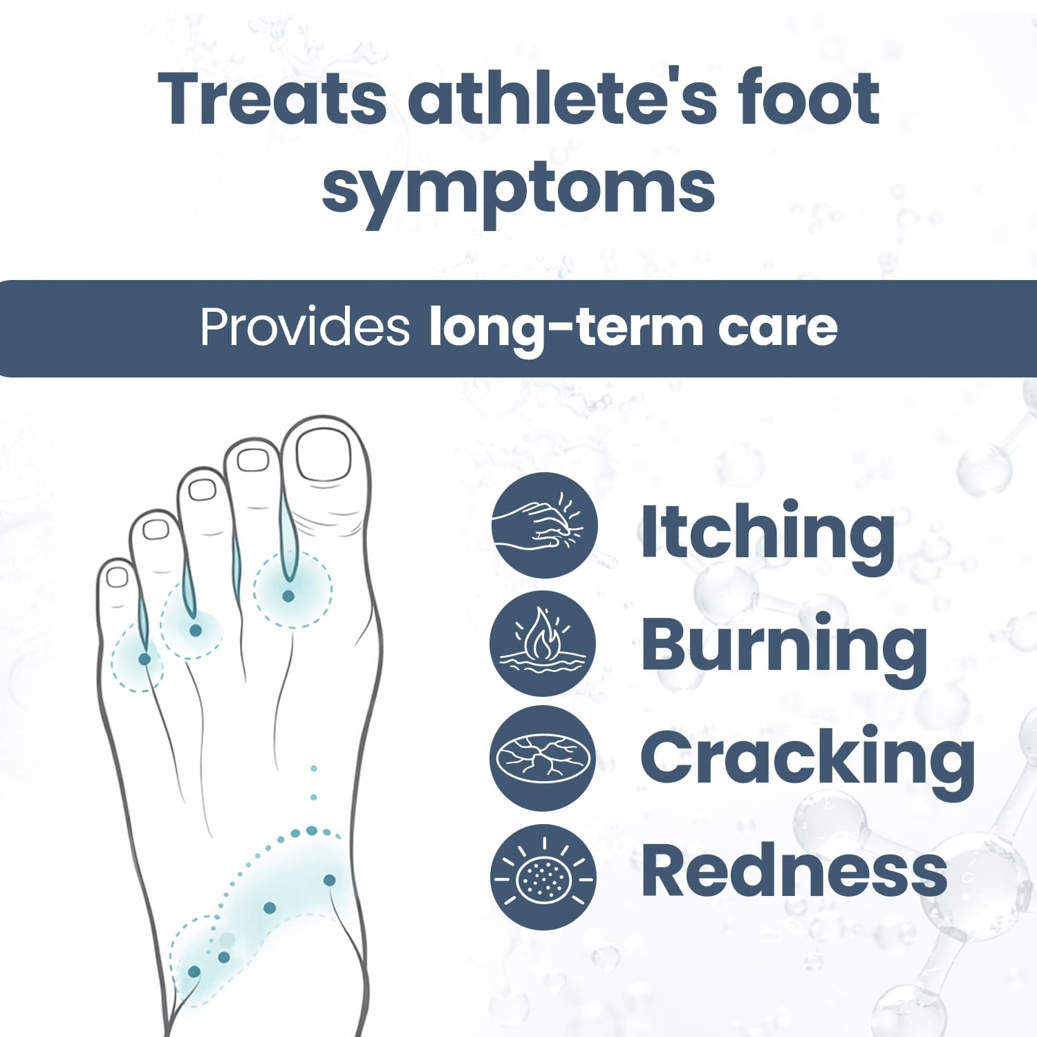 HONGOCURA - Athletes Foot Spray | 1 Fl Oz | 1-Pack